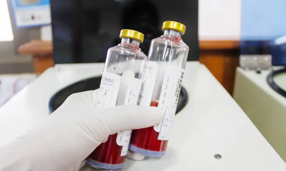 Blood Culture Test, Reports & Insights